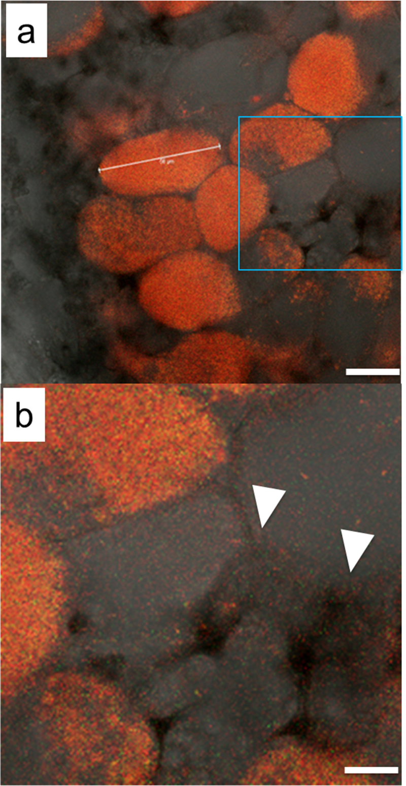 Both incompatible and compatible rhizobia inhabit the intercellular spaces of leguminous root nodules.