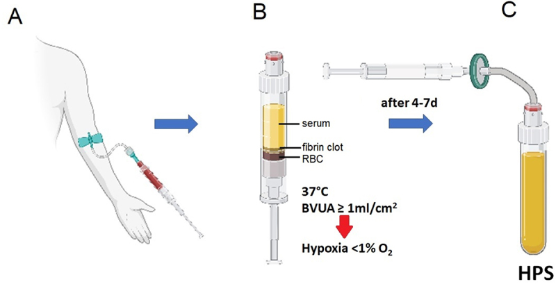 Full-thickness dermal wound regeneration using hypoxia preconditioned blood-derived growth factors: A case series.