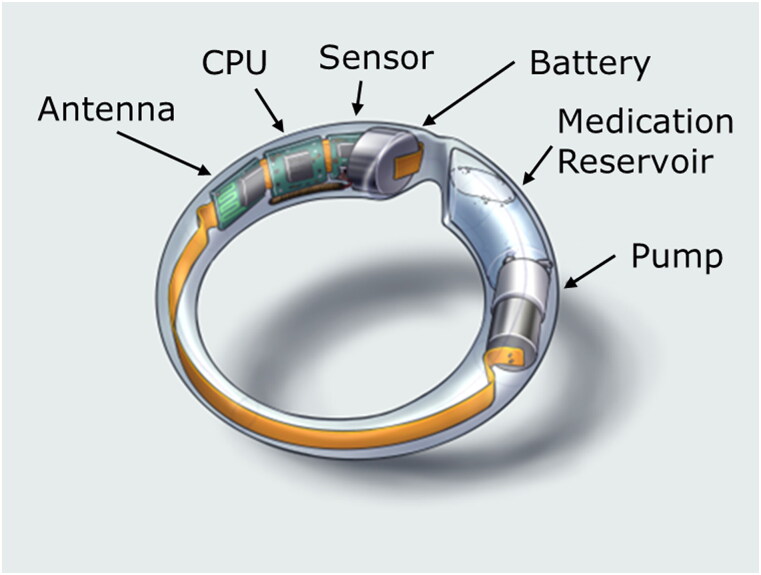 First-in-human study to assess the pharmacokinetics, tolerability, and safety of single-dose oxybutynin hydrochloride administered via a microprocessor-controlled intravaginal ring.