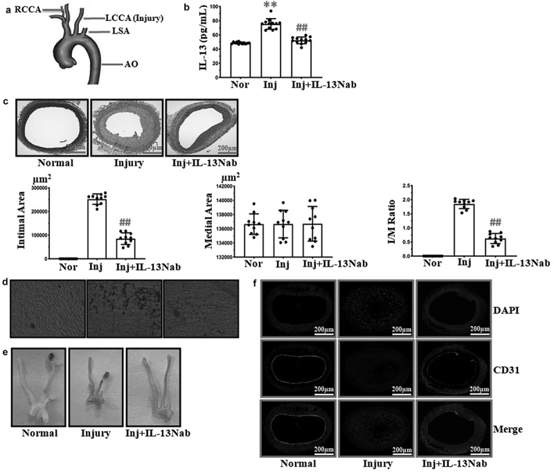 IL-13 neutralization attenuates carotid artery intimal hyperplasia and increases endothelial cell migration via modulating the JAK-1/STAT-3 signaling pathway.