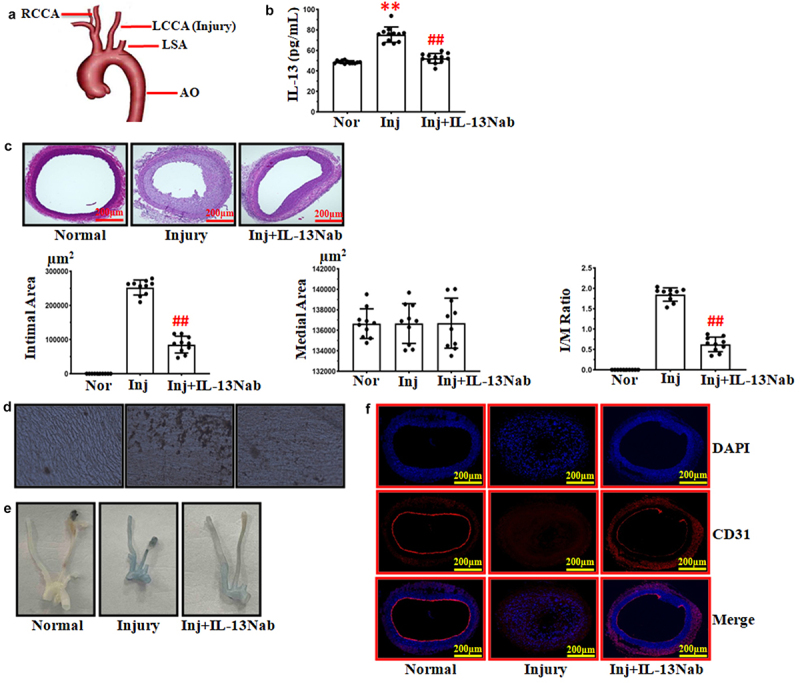 IL-13 neutralization attenuates carotid artery intimal hyperplasia and increases endothelial cell migration via modulating the JAK-1/STAT-3 signaling pathway.