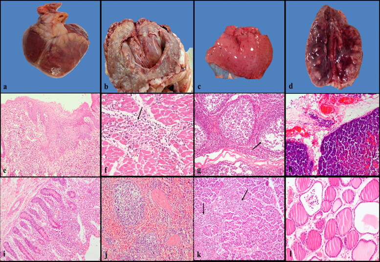 Novel pathologic findings and viral antigen distribution in cattle and buffalo calves naturally infected with Foot-and-Mouth disease virus.