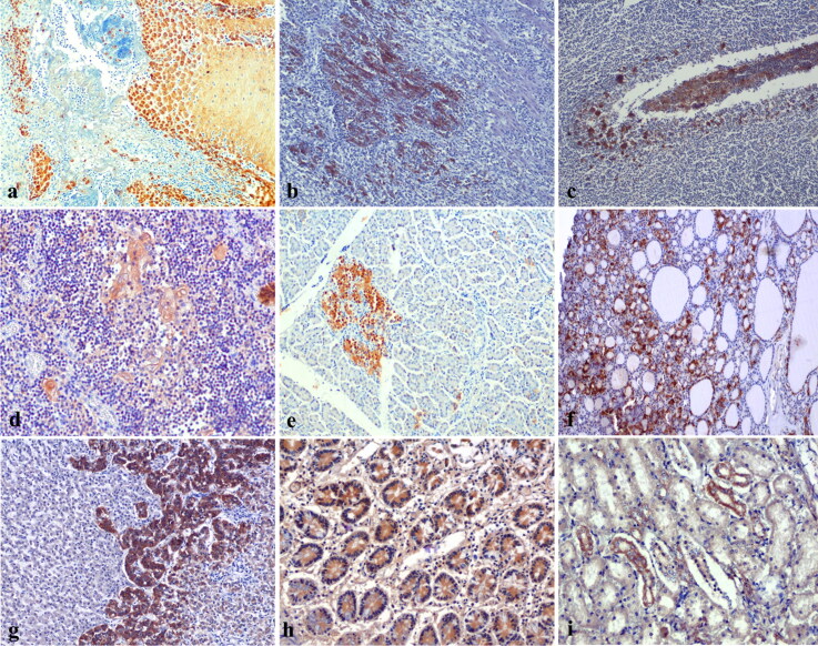 Novel pathologic findings and viral antigen distribution in cattle and buffalo calves naturally infected with Foot-and-Mouth disease virus.