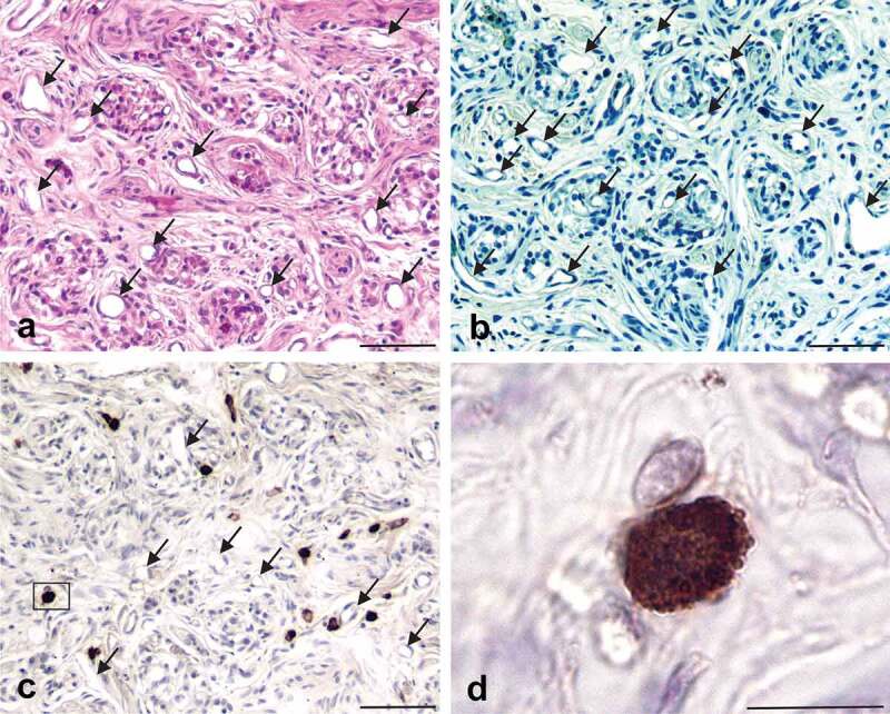 Expression of the cellular prion protein by mast cells in the human carotid body.