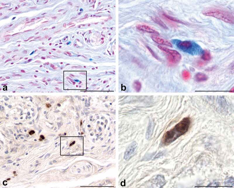 Expression of the cellular prion protein by mast cells in the human carotid body.