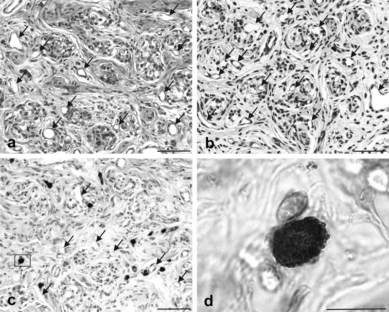 Expression of the cellular prion protein by mast cells in the human carotid body.