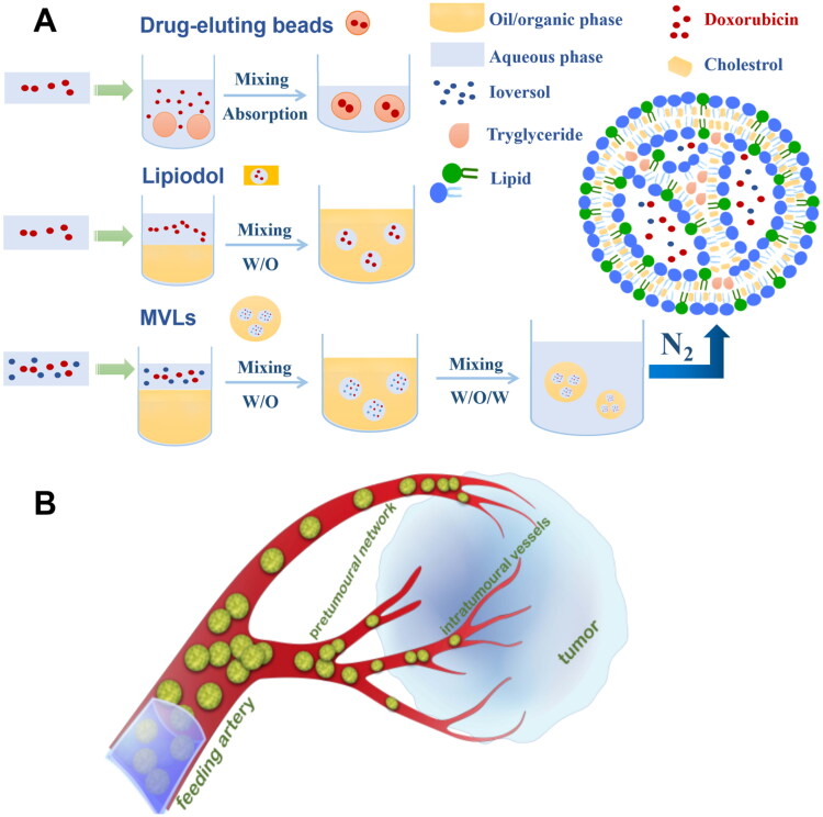 Impact of particle size of multivesicular liposomes on the embolic and therapeutic effects in rabbit VX2 liver tumor.