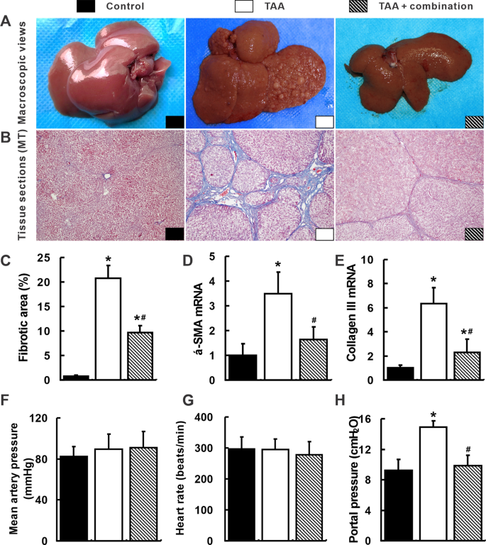 Correction: Celecoxib and octreotide synergistically ameliorate portal hypertension via inhibition of angiogenesis in cirrhotic rats