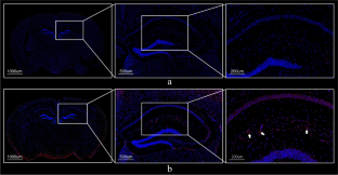 Proteomics revealed an association between ribosome-associated proteins and amyloid beta deposition in Alzheimer's disease.