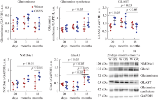 Differences in Changes in the Glutamate/GABA System Activity in the Rat Retina during Aging and the Development of Retinopathy at Nighttime and Daytime