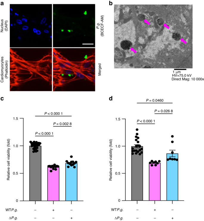 Porphyromonas gingivalis, a periodontal pathogen, impairs post-infarcted myocardium by inhibiting autophagosome-lysosome fusion.