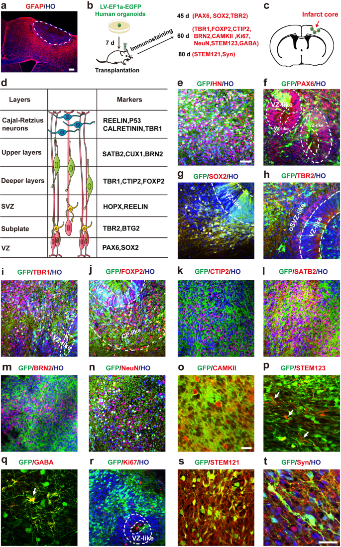 Cerebral organoids transplantation repairs infarcted cortex and restores impaired function after stroke.