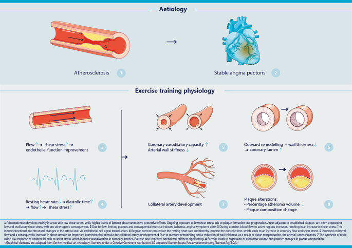 Exercise-based cardiac rehabilitation in stable angina pectoris: a narrative review on current evidence and underlying physiological mechanisms.