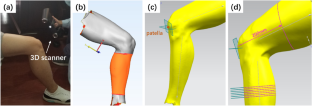 Estimation of the Skeletal Muscle Cross-Sectional Area of the Lower Extremity Using Structured Light Three-Dimensional Scanning Technology