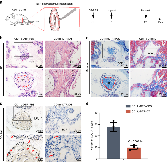 Role of dendritic cells in MYD88-mediated immune recognition and osteoinduction initiated by the implantation of biomaterials.