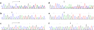 Analysis of an Inherited FXII Deficiency Pedigree Associated with Double Heterozygous Mutations in the F12 Gene.