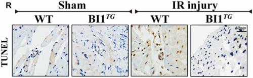 Correction to: BI1 is associated with microvascular protection in cardiac ischemia reperfusion injury via repressing Syk-Nox2-Drp1-mitochondrial fission pathways