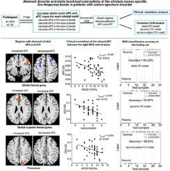 Aberrant dynamic and static functional connectivity of the striatum across specific low-frequency bands in patients with autism spectrum disorder