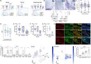 Notch ligands are biomarkers of anti-TNF response in RA patients