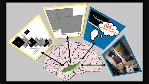 Conscious awareness and memory systems in the brain.