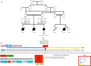 Whole exome sequencing identified a novel splice donor site variant in interleukin 2 receptor alpha chain.