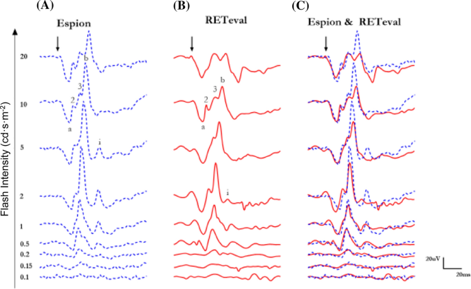 Comparing the RETeval<sup>®</sup> portable ERG device with more traditional tabletop ERG systems in normal subjects and selected retinopathies.