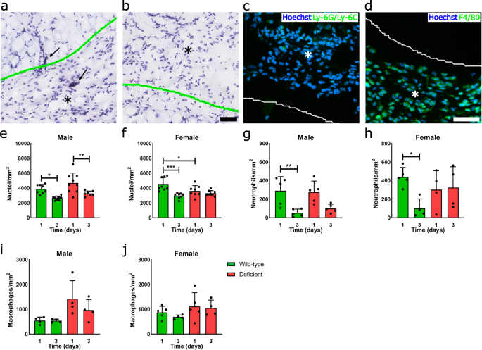 Immunomodulatory contribution of mast cells to the regenerative biomaterial microenvironment.