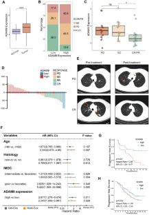 Unfavorable immunotherapy plus tyrosine kinase inhibition outcome of metastatic renal cell carcinoma after radical nephrectomy with increased ADAM9 expression.