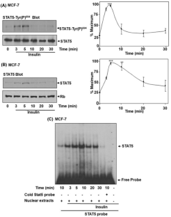 Caveolae Microdomains Mediate STAT5 Signaling Induced by Insulin in MCF-7 Breast Cancer Cells.