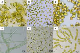 Skin allergenicity of airborne and soil algae isolated from Malaysia