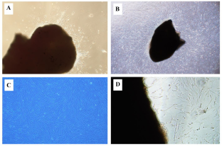 The Effects of Injectable Platelet-Rich Fibrin and Advanced-Platelet Rich Fibrin on Gingival Fibroblast Cell Vitality, Proliferation, Differentiation.