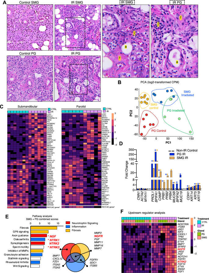 Neurotrophin signaling is a central mechanism of salivary dysfunction after irradiation that disrupts myoepithelial cells.