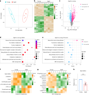 Polyamine metabolite spermidine rejuvenates oocyte quality by enhancing mitophagy during female reproductive aging