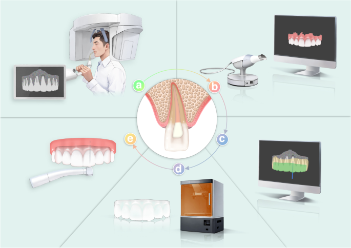 Expert consensus on digital guided therapy for endodontic diseases.