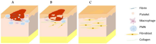 Basic Aspects of Skin Tissue Engineering: Cells, Biomaterials, Scaffold Fabrication Techniques, and Signaling Factors