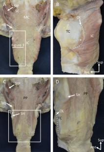 Evaluation of morphological features of palatopharyngeus insertion into the thyroid cartilage