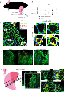 Regeneration process of myotendinous junction injury induced by collagenase injection between Achilles tendon and soleus muscle in mice