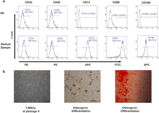 Paracrine Factors Released from Tonsil-Derived Mesenchymal Stem Cells Inhibit Proliferation of Hematological Cancer Cells Under Hyperthermia in Co-culture Model