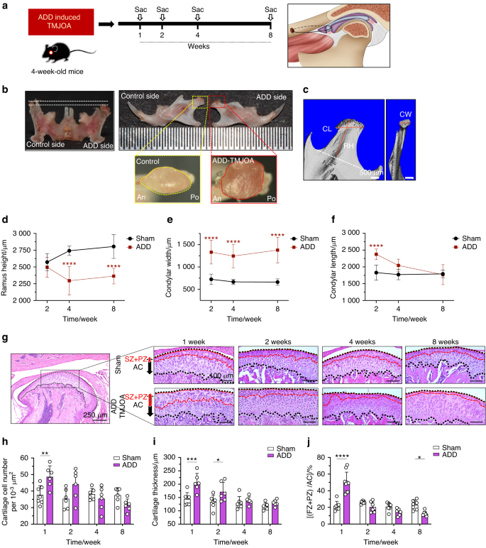 Divergent chondro/osteogenic transduction laws of fibrocartilage stem cell drive temporomandibular joint osteoarthritis in growing mice.