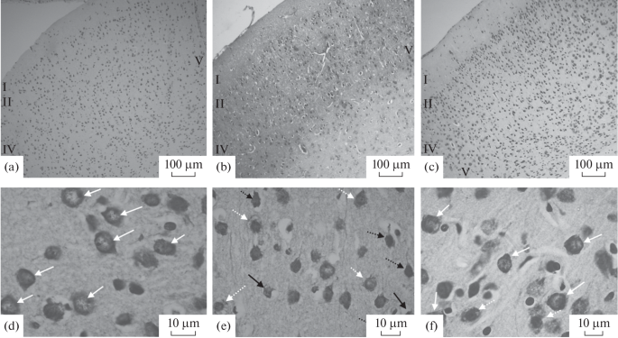 The IQ-1S JNK (c-Jun N-Terminal Kinase) Inhibitor Suppresses Premature Aging of OXYS Rat Brain