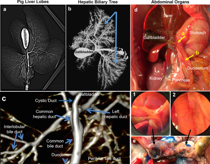 A postnatal network of co-hepato/pancreatic stem/progenitors in the biliary trees of pigs and humans.