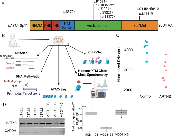 KAT6A mutations in Arboleda-Tham syndrome drive epigenetic regulation of posterior HOXC cluster.