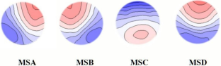 Electroencephalography Microstate Class D is a Brain Marker of Subjective Sleep Quality for College Students with High Habitual Sleep Efficiency.