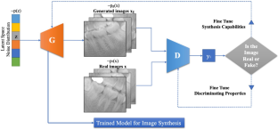 Generative adversarial networks in dental imaging: a systematic review.