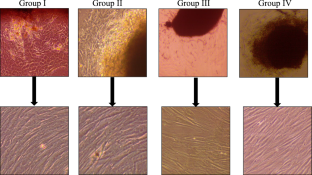 Long-term cryopreservation of whole gingival tissue.