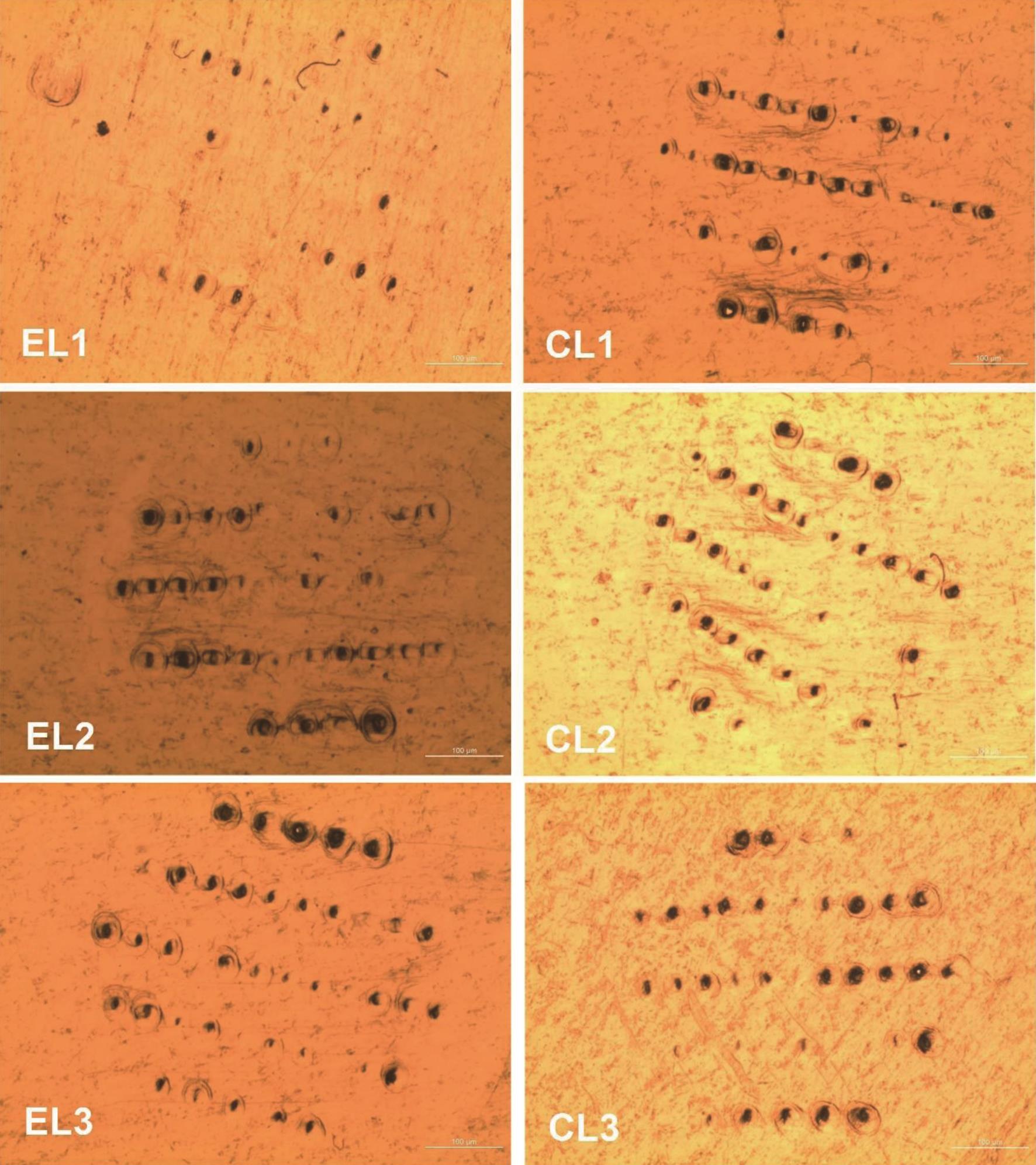 Formulation and Characterization of Lacosamide-loaded Polymeric Microneedles