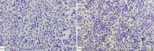 Growth and Molecular Characteristics of Temozolomide-Resistant Human A172 and R1 Glioblastoma Cells