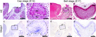 Developmental roles of glomerular epithelial protein-1 in mice molar morphogenesis.