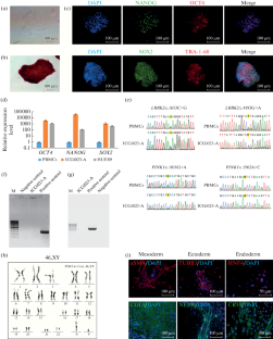 An Induced Pluripotent Stem Cell Line (ICGi023-A) Obtained from a Patient with Parkinson’s Disease Associated Polymorphisms in LRRK2 and PINK1 Genes