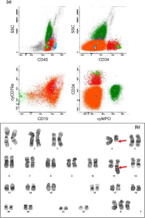 Lineage switch of KMT2A-rearranged adult B-lineage acute lymphoblastic leukemia following bispecific T-cell engager and monoclonal antibody therapy.